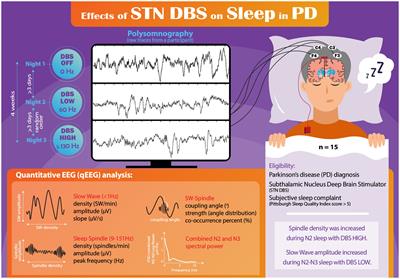 Effects of deep brain stimulation on quantitative sleep electroencephalogram during non-rapid eye movement in Parkinson’s disease